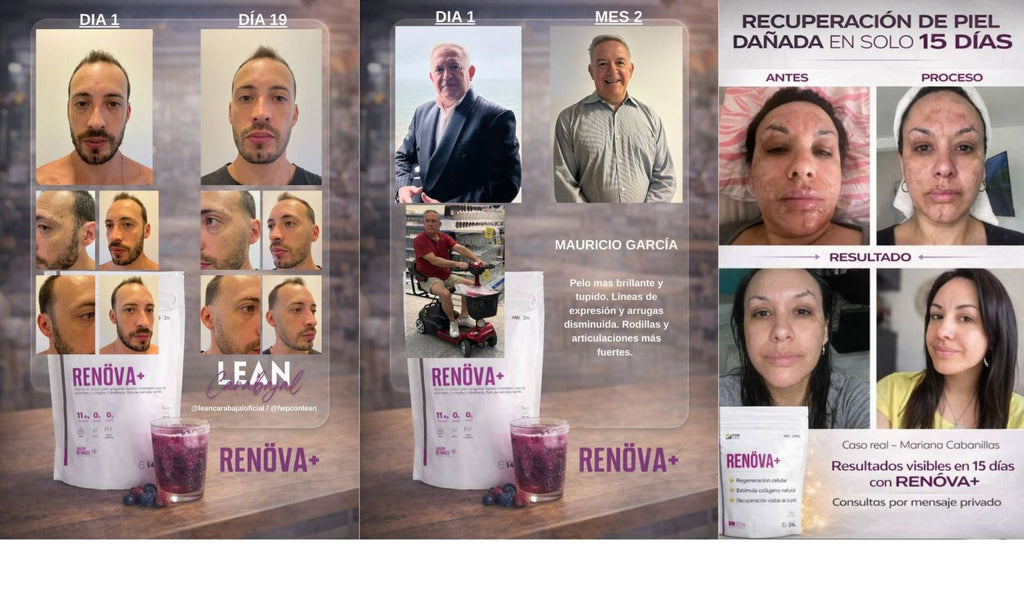 RENOVA