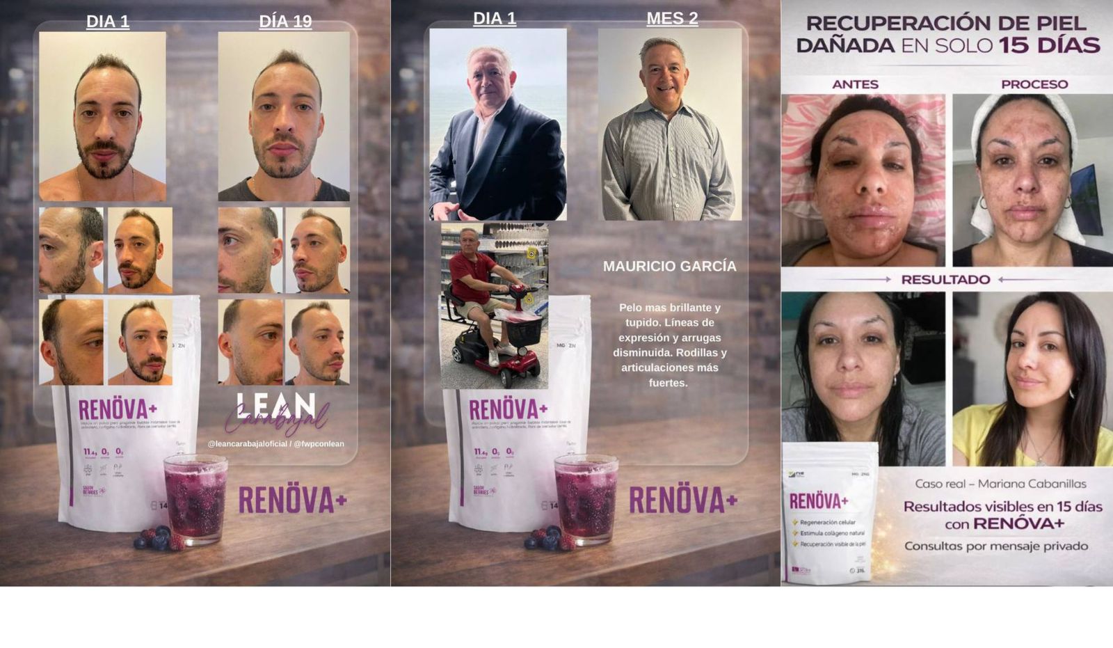 RENOVA